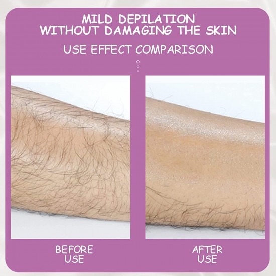 Кристален уред за епилация,  Crystal Hair Removal