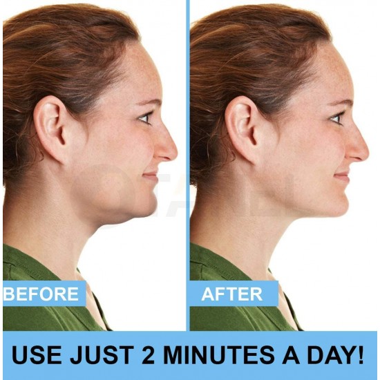  Уред за премахване на двойна брадичка NECKLINE SLIMMER