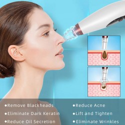 Вакуум уред за премахване на черни точки и акне